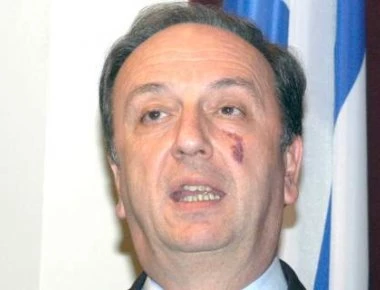 Πέθανε ο πρώην υπουργός της ΝΔ Γιώργος Καλός